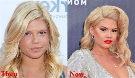 chanel west coast before surgery|Chanel West Coast Slams Plastic Surgery Rumors